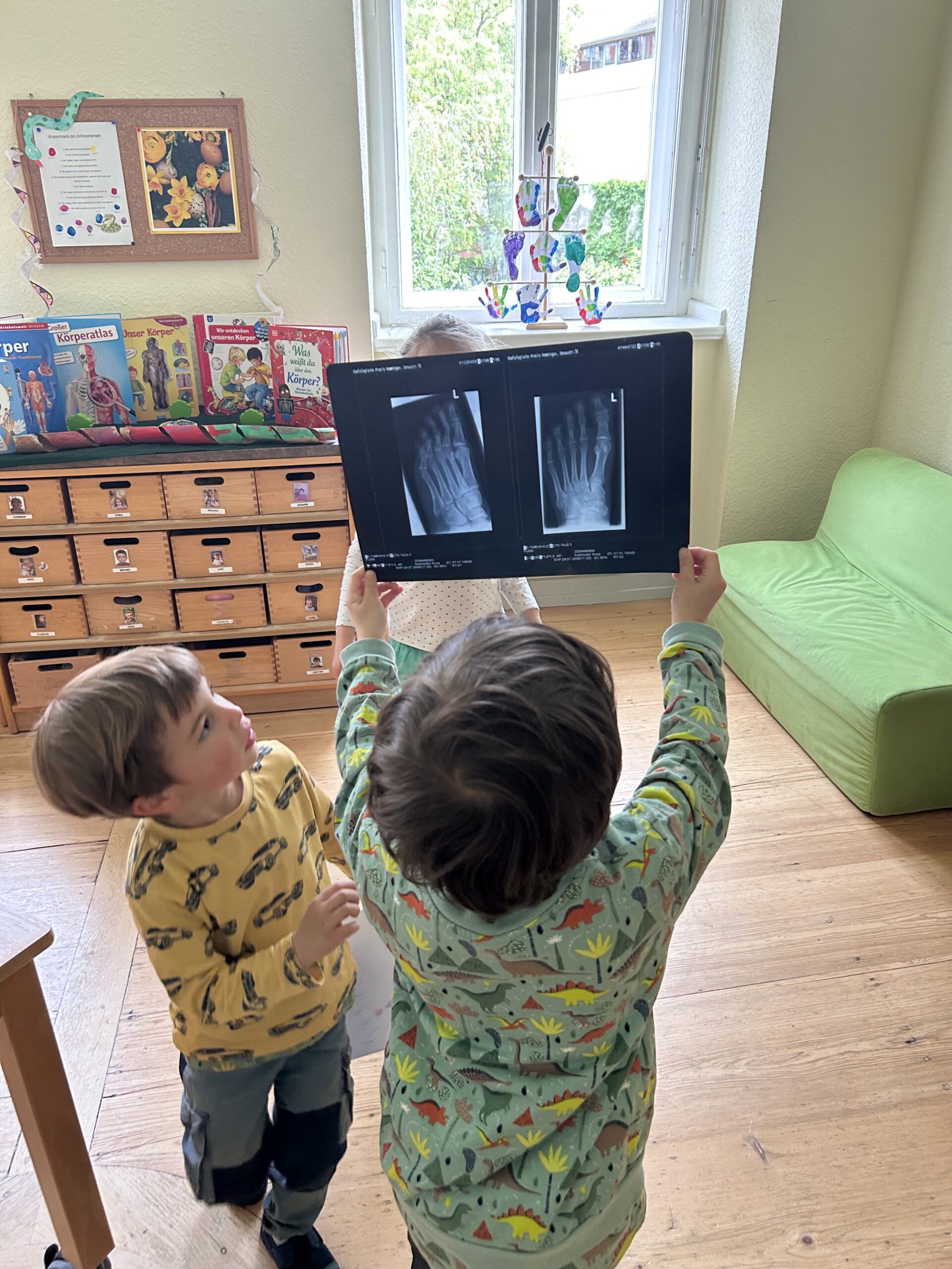 Mein-Körper-Projekt, Röntigenbilder.